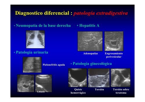 ABDOMEN AGUDO LO QUE SE DEBE Y NO SE DEBE HACER