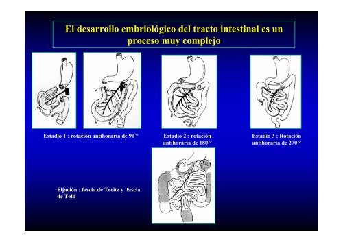 ABDOMEN AGUDO LO QUE SE DEBE Y NO SE DEBE HACER