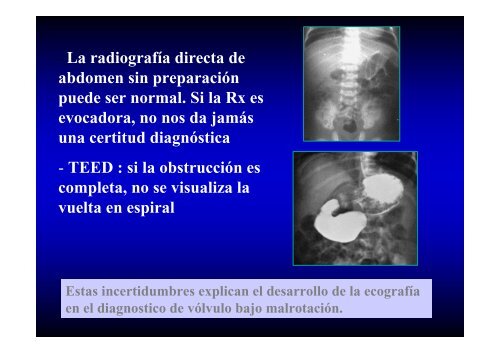 ABDOMEN AGUDO LO QUE SE DEBE Y NO SE DEBE HACER