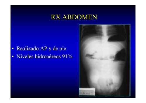 ABDOMEN AGUDO LO QUE SE DEBE Y NO SE DEBE HACER