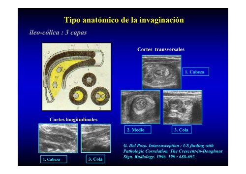 ABDOMEN AGUDO LO QUE SE DEBE Y NO SE DEBE HACER