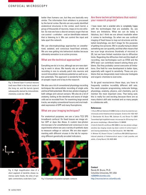 reSOLUTION_Research_09_Neuroscience - Leica Microsystems