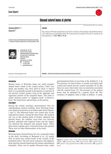 Unusual sutural bones at pterion - IJAV â¢ International Journal of ...