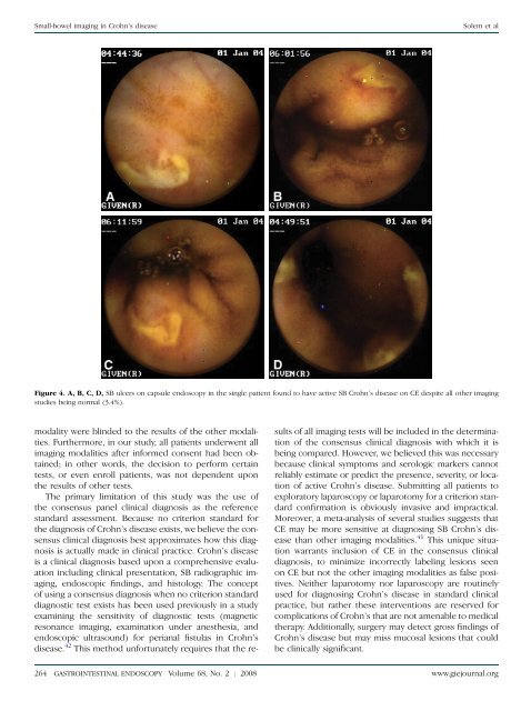 Small-bowel imaging in Crohn's disease: a prospective, blinded, 4 ...