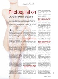 Photoepilation - Wellcomet