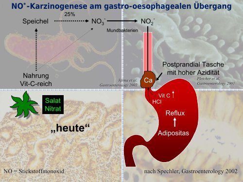 Corpus-dominante HP-Gastritis - gastroenterologie-wintertreffen.at