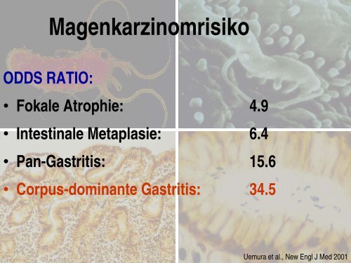 Corpus-dominante HP-Gastritis - gastroenterologie-wintertreffen.at