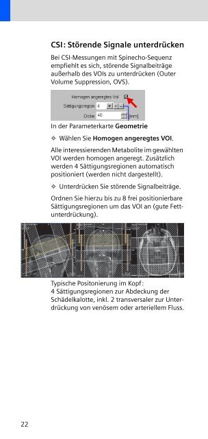 Auswertung - Siemens Healthcare