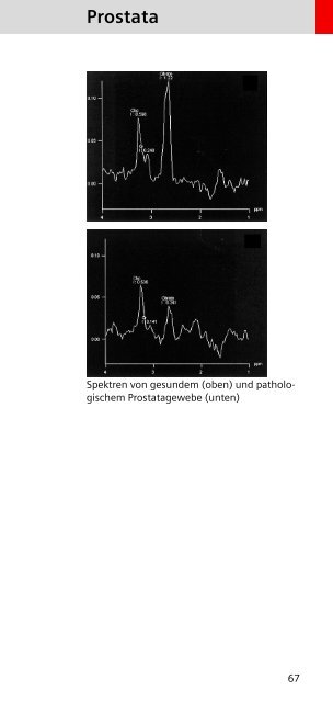 Auswertung - Siemens Healthcare