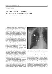 Fijación y Desplazamiento de Catéteres Venosos Centrales