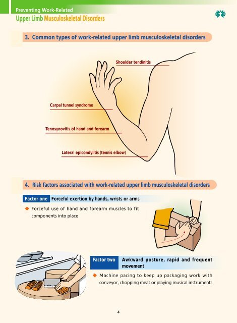 2. What are work-related upper limb musculoskeletal disorders?