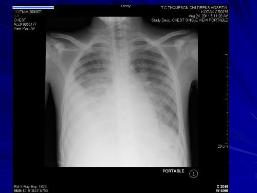 Bringing Ultrasound to the Bedside in Pediatrics