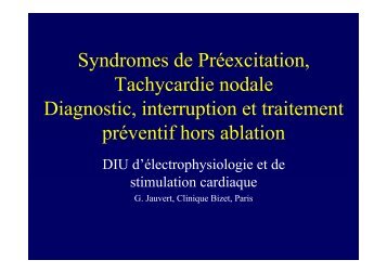 T Nodales, WPW hors ablation