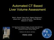 Automated CT Based Liver Volume Assessment - Definiens