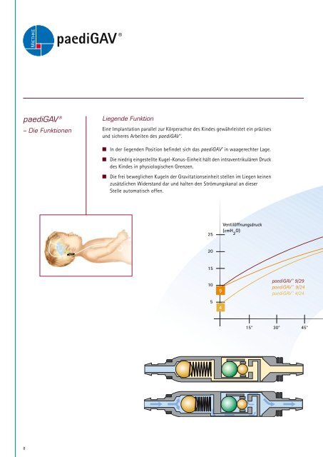 Aesculap Neurosurgery paediGAV® - Miethke