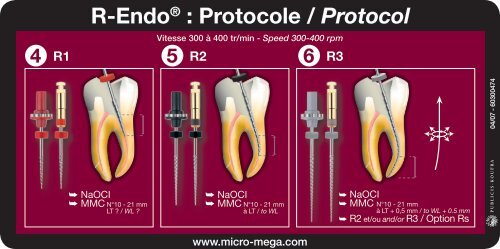 R-Endo® : Protocole / Protocol - Micro Mega