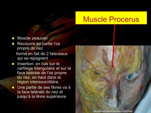 Le muscle PROCERUS - bienvenue sur le site de l'amiform