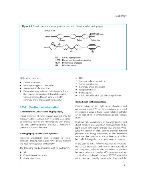 Essential Revision Notes for MRCP Third Edition - PasTest