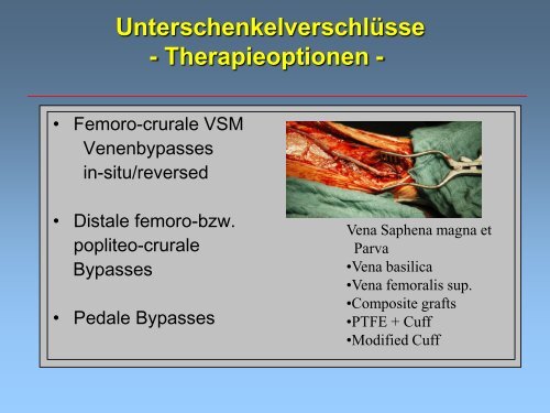 (pAVK) und Diabetes mellitus