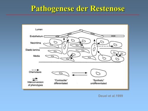 (pAVK) und Diabetes mellitus