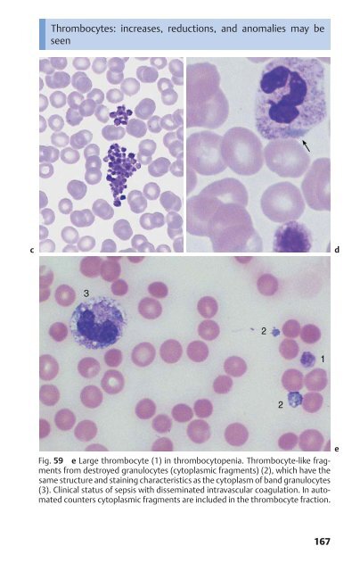 Color Atlas of Hematology - Practical Microscopic and Clinical ...