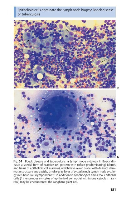 Color Atlas of Hematology - Practical Microscopic and Clinical ...