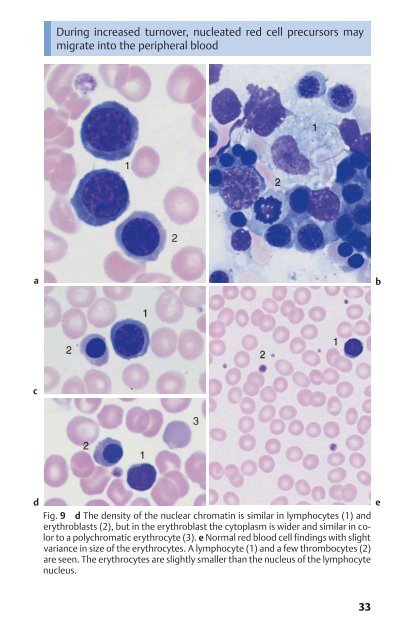 Color Atlas of Hematology - Practical Microscopic and Clinical ...