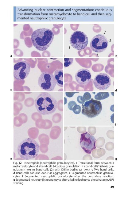 Color Atlas of Hematology - Practical Microscopic and Clinical ...