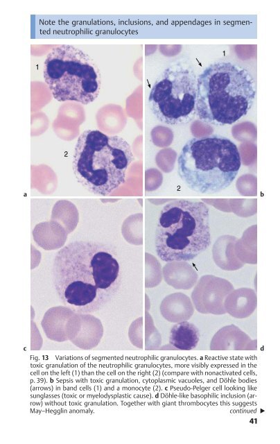 Color Atlas of Hematology - Practical Microscopic and Clinical ...