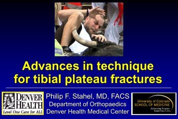 Treatment Options for Tibial Plateau Fractures