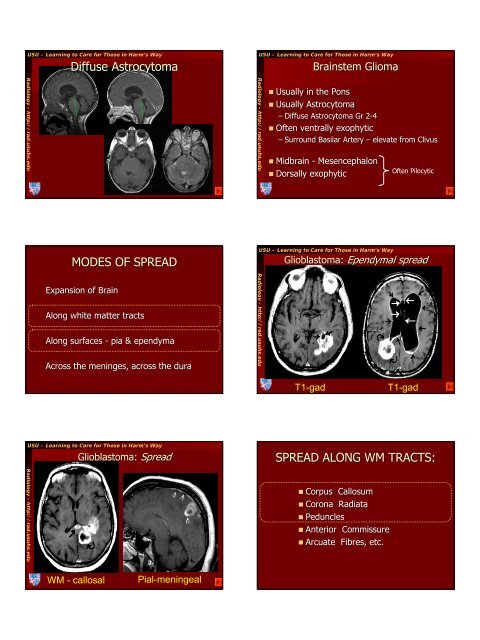 the who 2000 tumor classification - Radiology - Uniformed Services ...