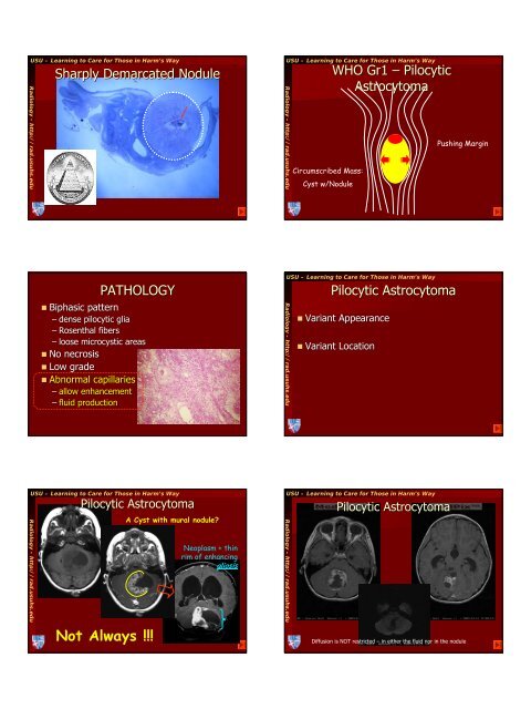 the who 2000 tumor classification - Radiology - Uniformed Services ...