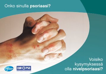 Onko sinulla psoriaasi? - Pfizer