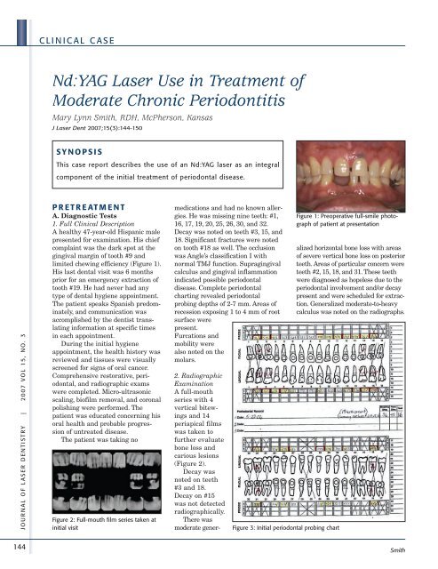 Optimizing visualization and ergonomics. - Academy of Laser Dentistry