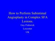 How to Perform Subintimal Angioplasty in Complex SFA Lesions.