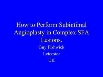 How to Perform Subintimal Angioplasty in Complex SFA Lesions.