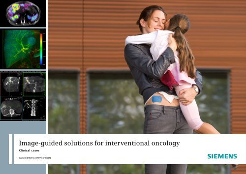 Image-guided solutions for interventional oncology - Siemens ...