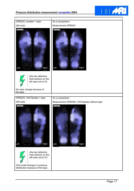 Biomechanikstudy_MRI_AKT-O_EN.pd - VACOped