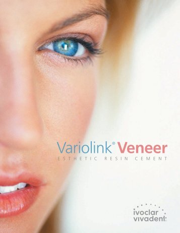 Variolink Veneer Brochure - Keating Dental Lab