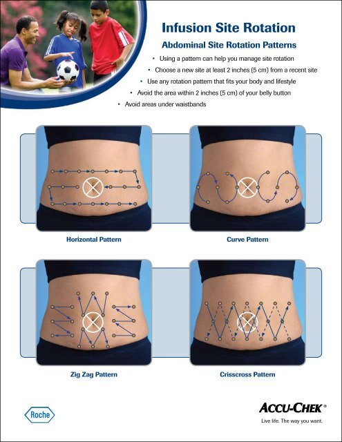 Importance of Site Rotation Guide - ACCU-CHEK Insulin Pumps