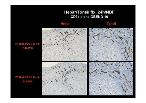 Antigen Retrieval - NordiQC