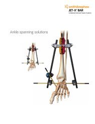 Jet-X Large Ankle Spanning Solutions.pdf - Bonerepmedical.com