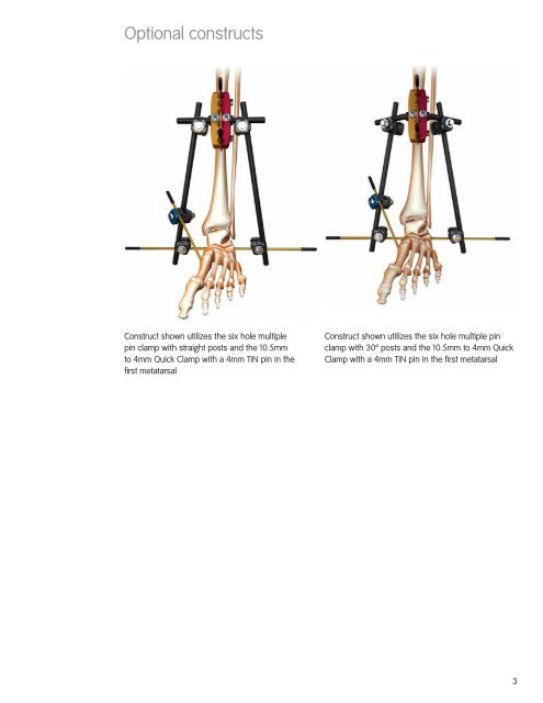 Jet-X Large Ankle Spanning Solutions.pdf - Bonerepmedical.com