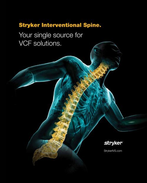 Your single source for VCF solutions. Stryker Interventional Spine