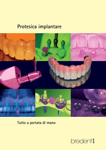 Im plantologia Odontotecnica - bredent medical GmbH & Co.KG