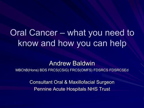 Oral Cancer â what you need to know and how you can help