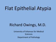 Flat epithelial Atypia - UAMS Medical Center