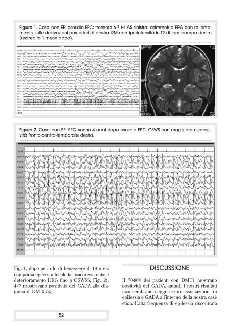 Bollettino nÂ° 138 - Lice