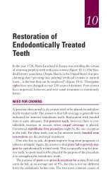 Ch10: RESTORATION OF ENDODONTICALLY TREATED TEETH