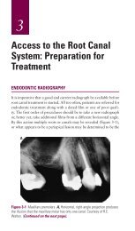 Ch03: ACCESS TO THE ROOT CANAL SYSTEM: PREPARATION ...